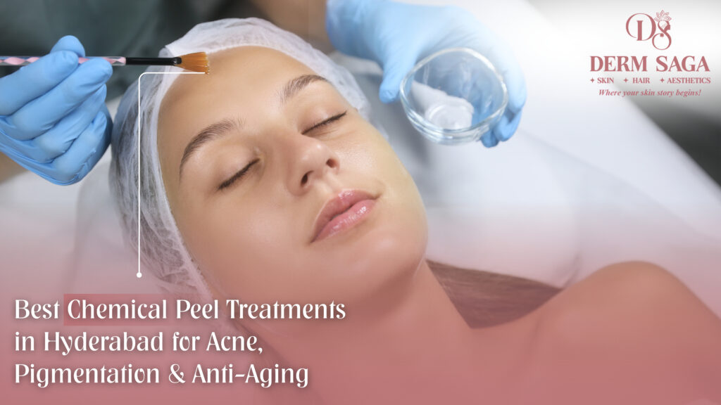 Best Chemical Peel Treatments in Hyderabad for Acne, Pigmentation & Anti-Aging