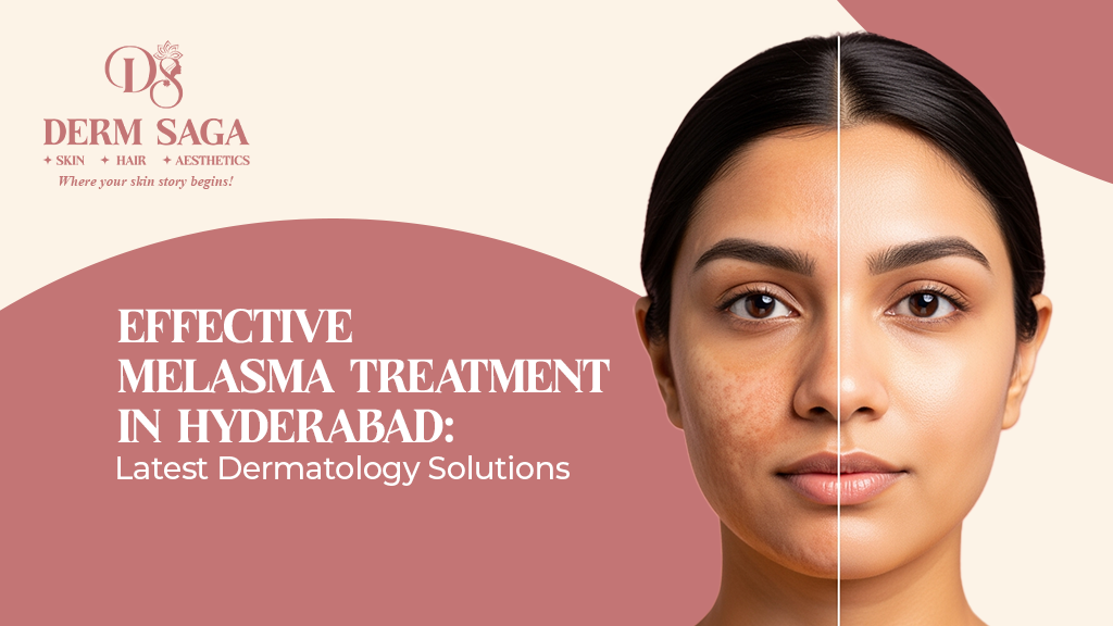 Effective-Melasma-Treatment-in-Hyderabad-Latest-Dermatology-Solutions
